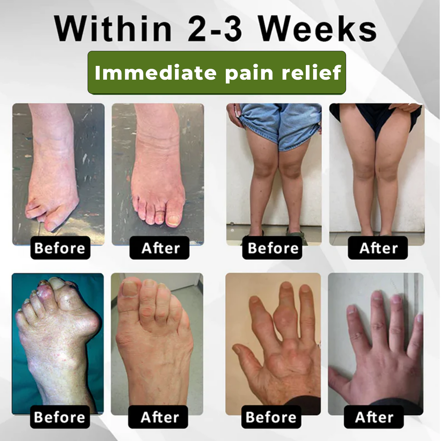 Cvreoz®SNAKE PEPTIDE 3X Instant Joint Pain Relief Gel✨𝐍𝐞𝐰 𝐈𝐧𝐠𝐫𝐞𝐝𝐢𝐞𝐧𝐭,𝐒𝐧𝐚𝐤𝐞 𝐏𝐞𝐩𝐭𝐢𝐝𝐞