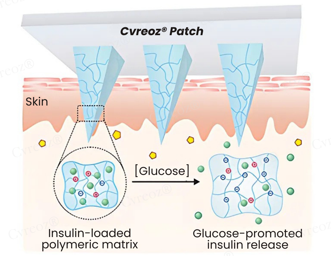 Cvreoz® InsuliNeedle Glucose Control Microneedling Patch