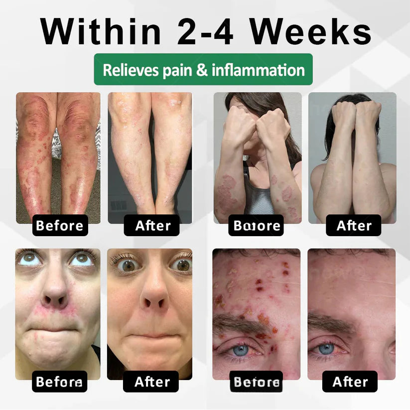 Cvreoz®Snake Peptide Shingles Skincare Ampoules