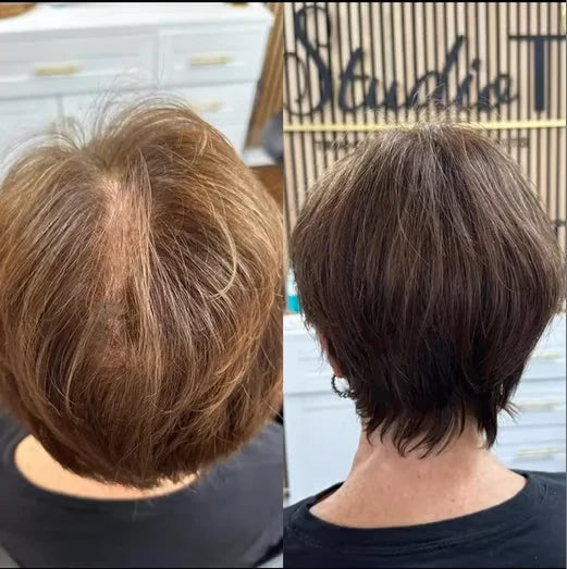 💥Breathable Natural Hair Tips for Women with Thinning Hair
