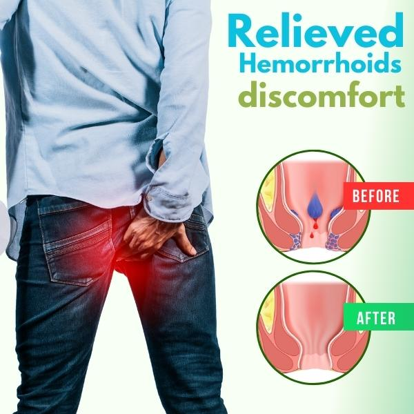 🔥Hot Sell 🔥Sirona® Herbal Hemorrhoid Spray