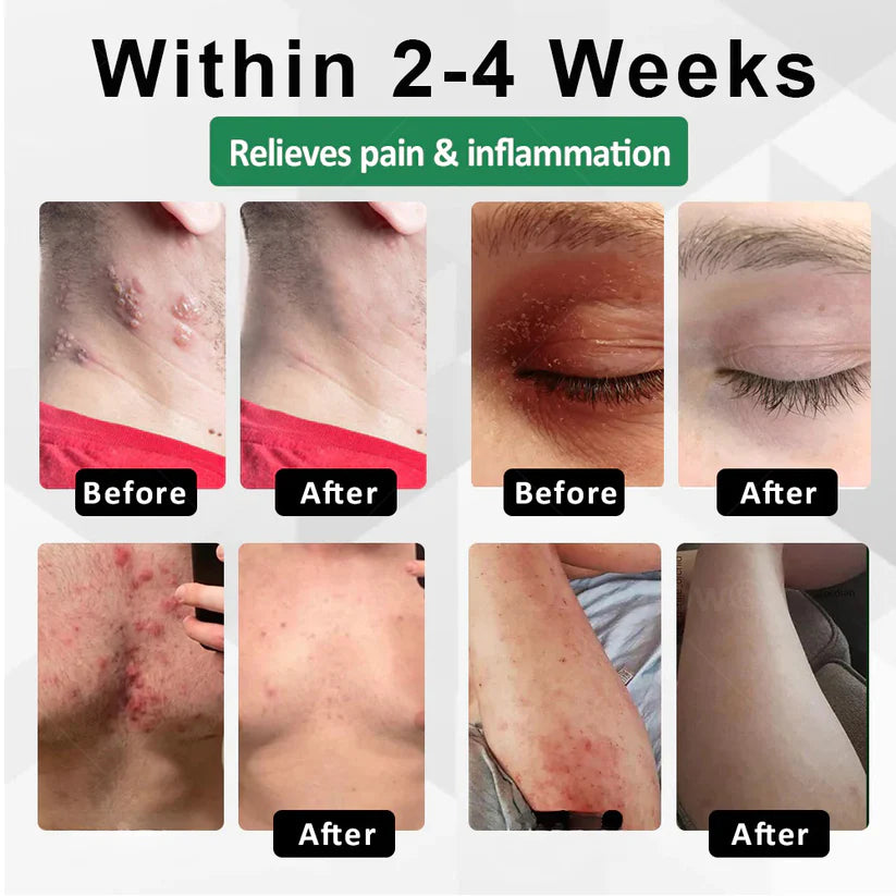 Cvreoz®Snake Peptide Shingles Skincare Ampoules