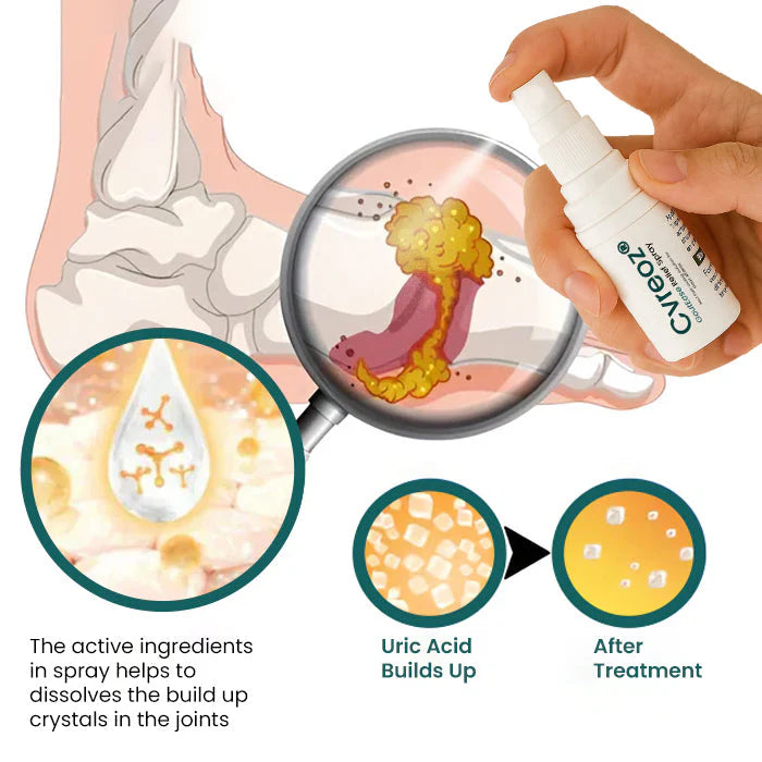 🔥Hot Sales - 50% OFF🌿Cvreoz® GoutEase Relief Spray