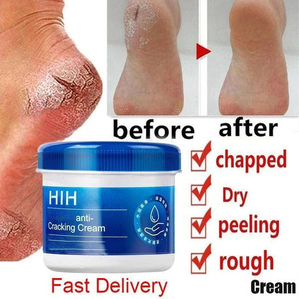 💖Foot Cream Anti-Crack Moisturizing Foot Beauty