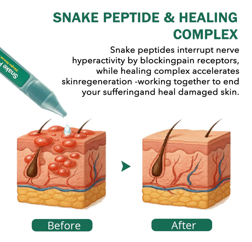 Cvreoz®Snake Peptide Shingles Skincare Ampoules