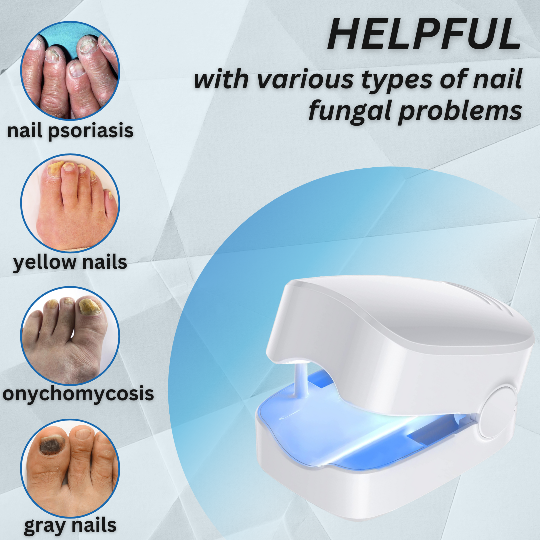 Bikenda® Nail Fungus ✅ 𝕤𝕒𝕧𝕖 𝕦𝕡 𝕥𝕠 8𝟘% Laser Treatment Device