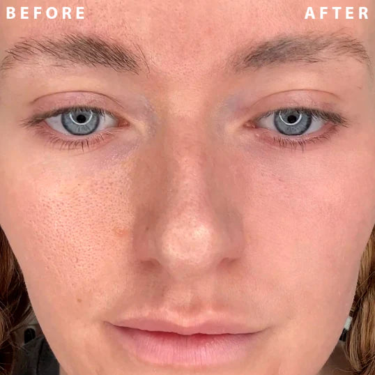 🔥Power Redo Wrinkle Fix(🔥Limited Time Discount)
