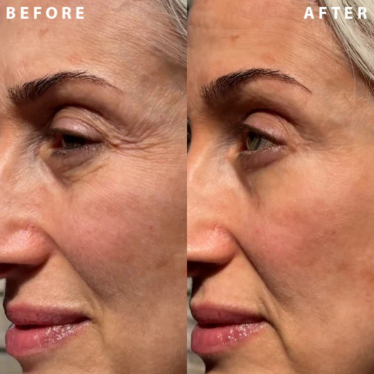 🔥Power Redo Wrinkle Fix(🔥Limited Time Discount)
