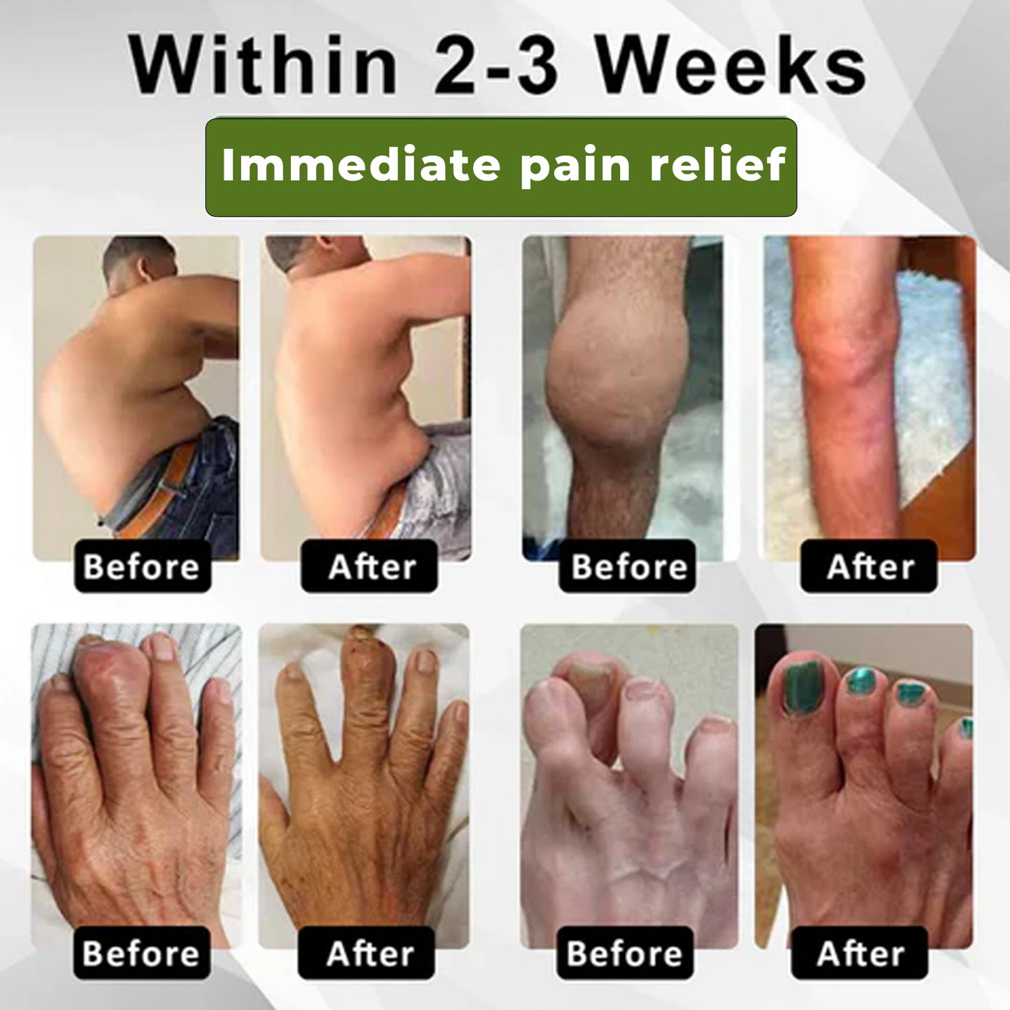 Cvreoz®SNAKE PEPTIDE 3X Instant Joint Pain Relief Gel✨𝐍𝐞𝐰 𝐈𝐧𝐠𝐫𝐞𝐝𝐢𝐞𝐧𝐭,𝐒𝐧𝐚𝐤𝐞 𝐏𝐞𝐩𝐭𝐢𝐝𝐞