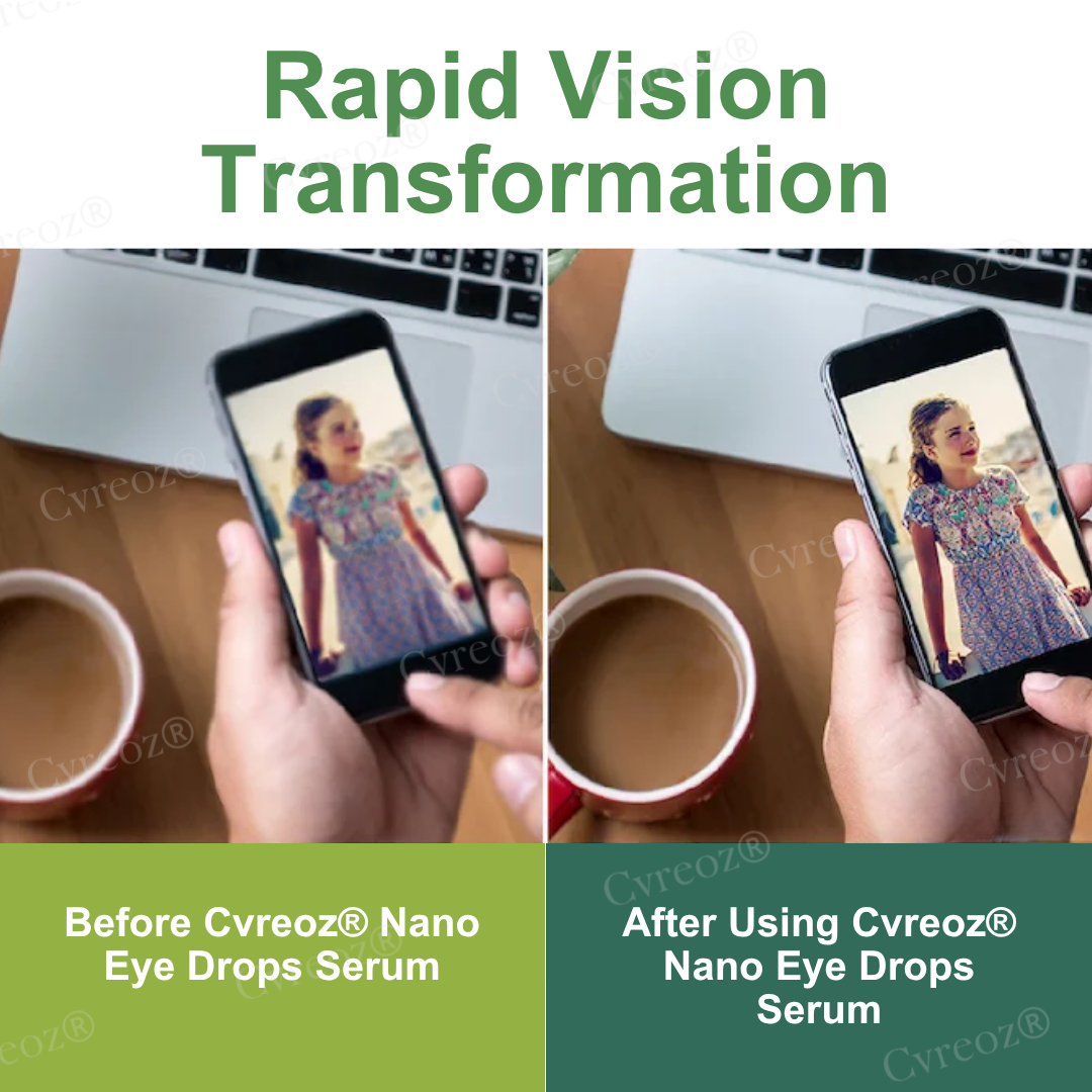 Cvreoz® Nano Eye Drops Serum for Presbyopia and Myopia (8️⃣0️⃣% 🇴🇫🇫 𝔼𝕟𝕕𝕤 𝕚𝕟 1️⃣0️⃣ 𝕞𝕚𝕟𝕦𝕥𝕖𝕤❗)