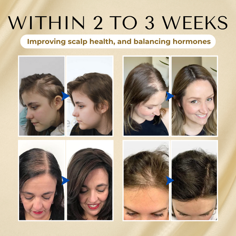 🔥 Grow Your Glow: 60% OFF 🔥 Cvreoz® Biotin Hair Essential Oil!