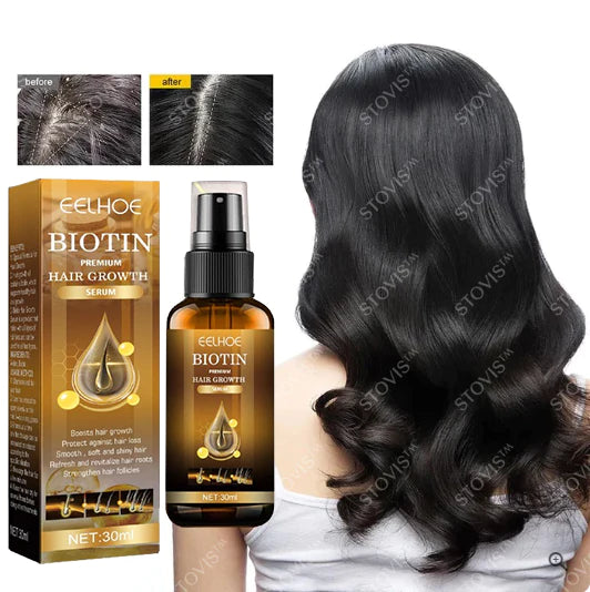 🔥Last Day Promotion - SAVE 70% OFF -Stovis™ Biotin Hair Booster