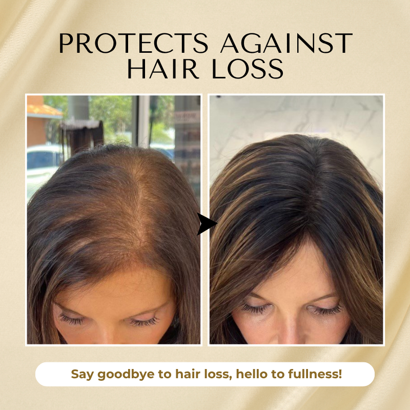 🔥 Grow Your Glow: 60% OFF 🔥 Cvreoz® Biotin Hair Essential Oil!