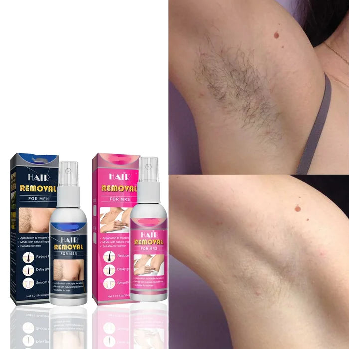 🔥Body Hair Removal Spray