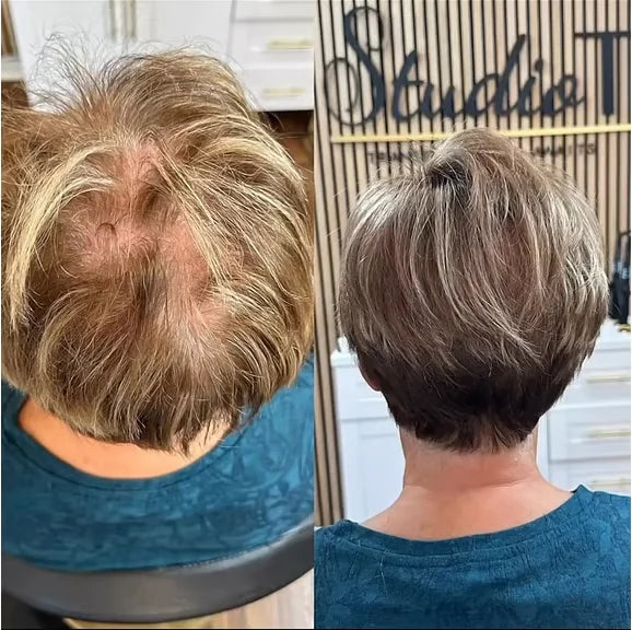 💥Breathable Natural Hair Tips for Women with Thinning Hair