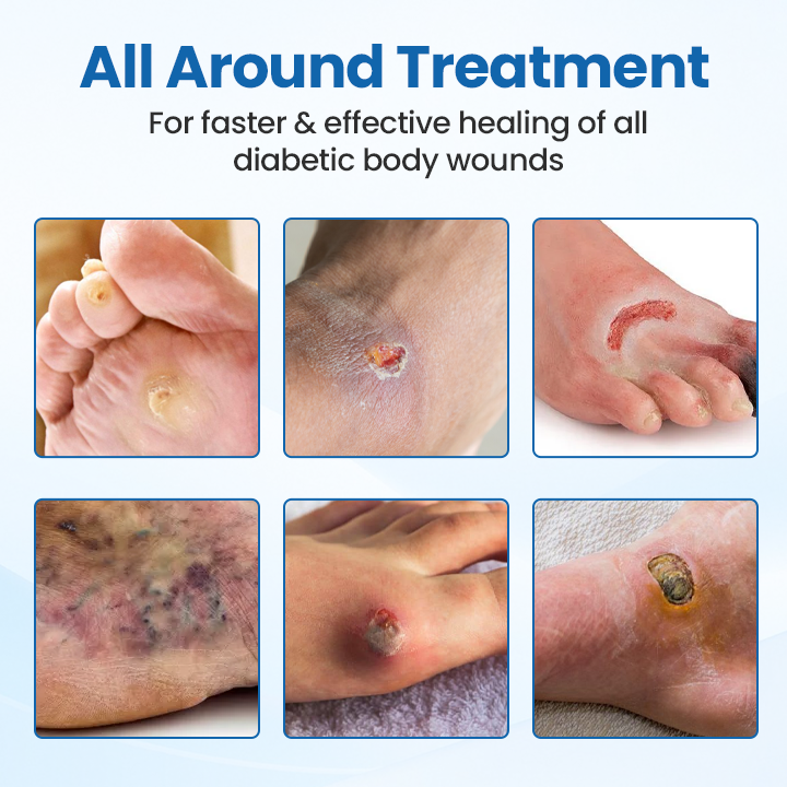 ✨[Official Store]✨ CZTICLE® DiabeHeal Skin Recovery Band