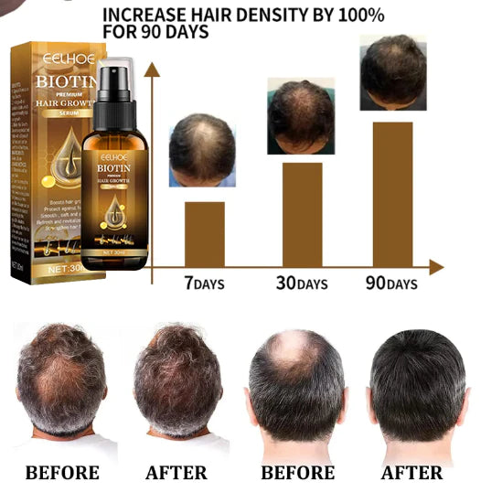 🔥Last Day Promotion - SAVE 70% OFF -Stovis™ Biotin Hair Booster