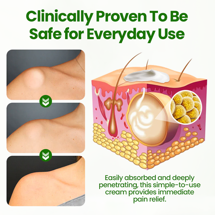 Biancat® KnotAway Lipoma Removal Cream