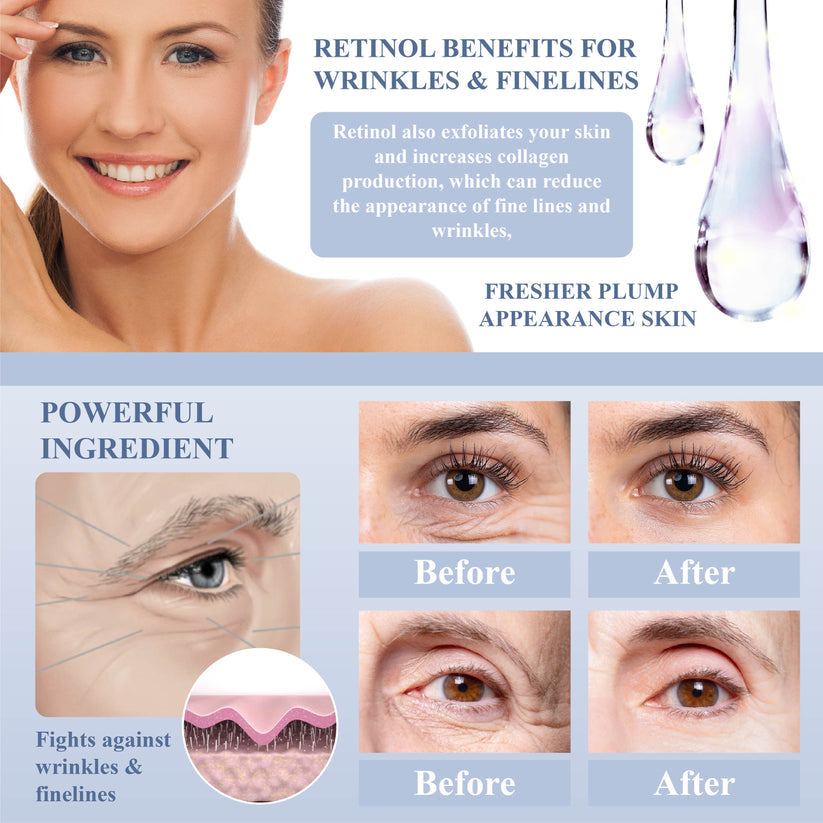 DefyAge™ EyeRepair Treatment Cream