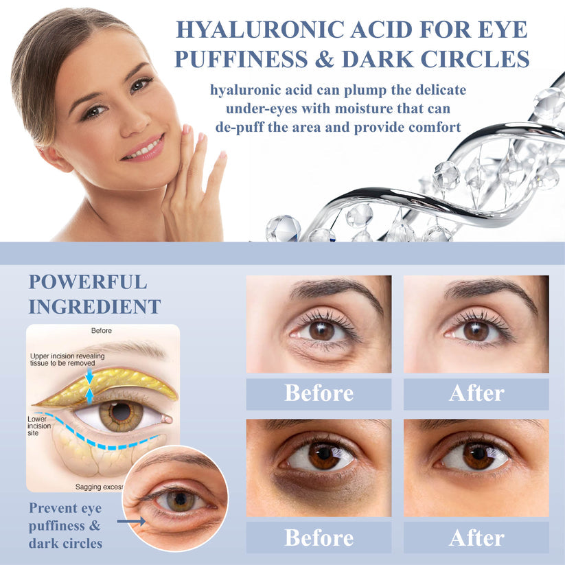 DefyAge™ EyeRepair Treatment Cream