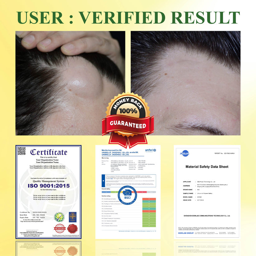 DetoxFlow™ Lymphatic Support SwellingEase Oil