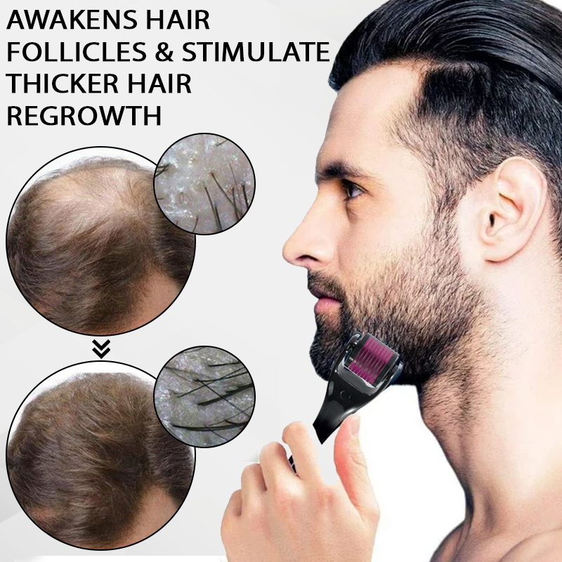 FolliFusion™ Max Absorb  MinoxidilSerum Dermaroller Kit