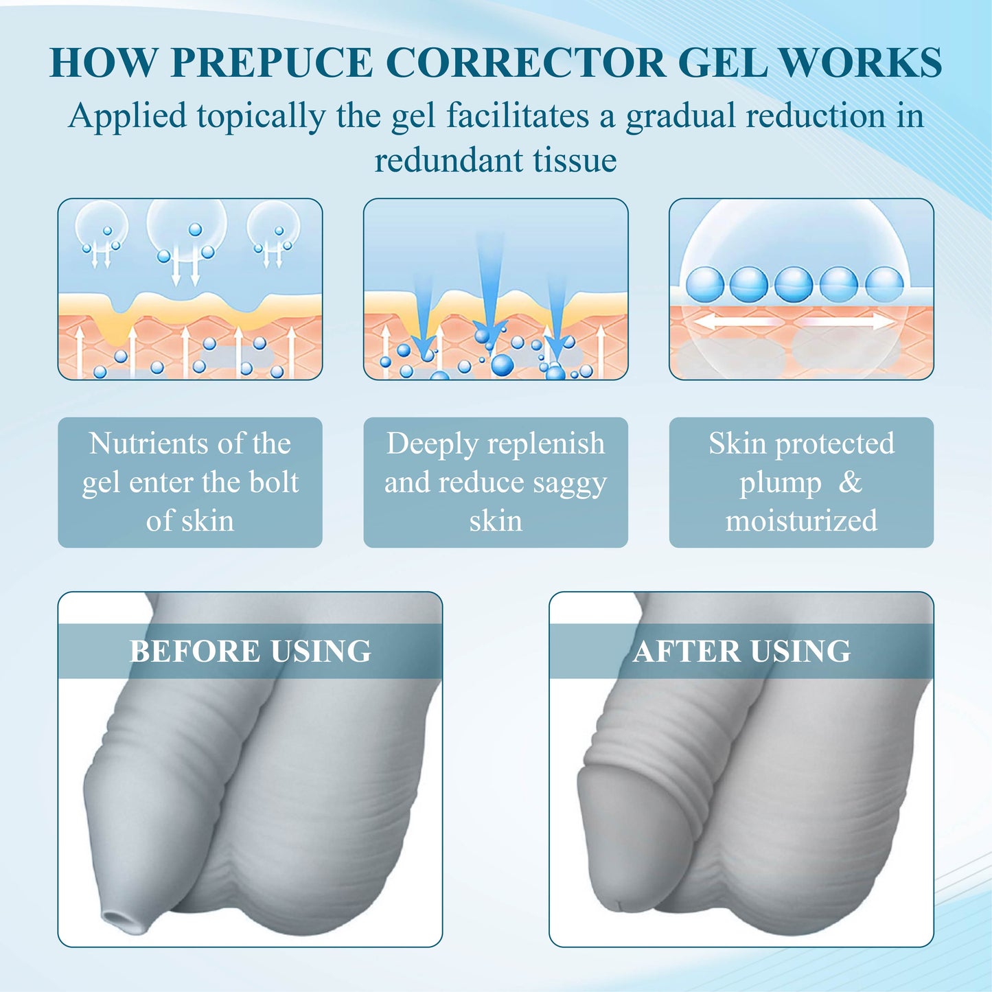 MaleGuard™  Redundant PrepuceCorrector Gel