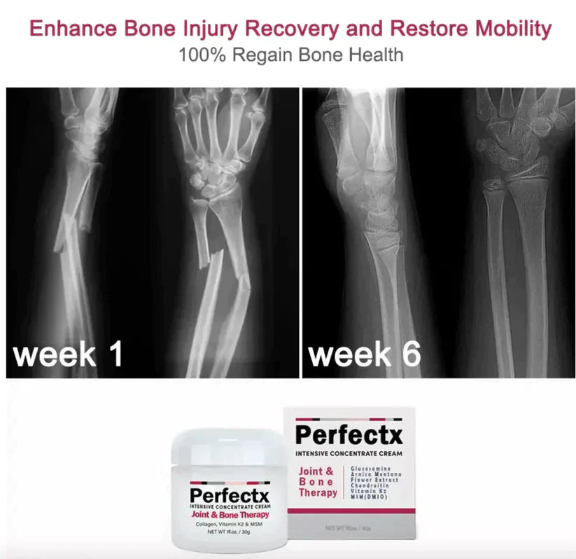 🔥LAST DAY Promotion 45% OFF🔥Perfectx Joint And Bone Therapy Cream