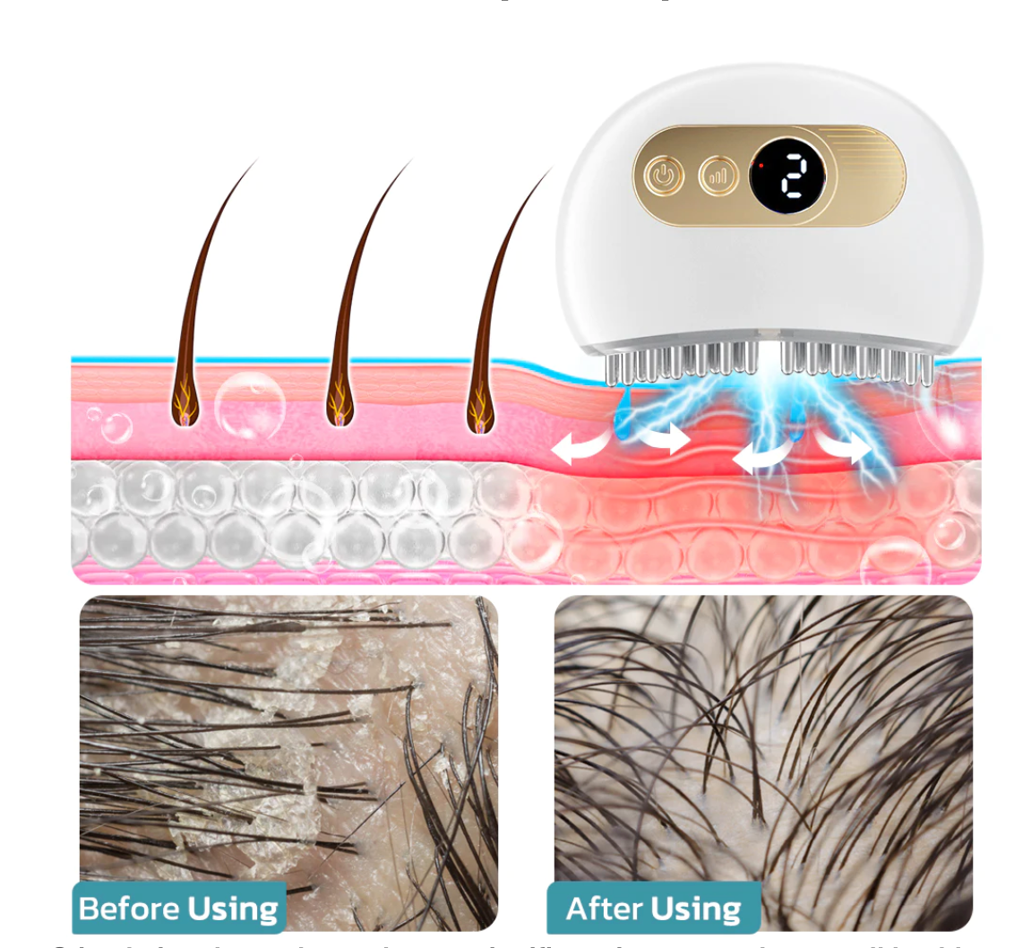 Icetal™ EMS Lifting Facial And Nourishing Scalp Acupoint Massage Device