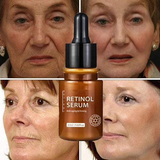 🔥HOT SALE 49% OFF--New Retinol™ Anti Aging Face Serum