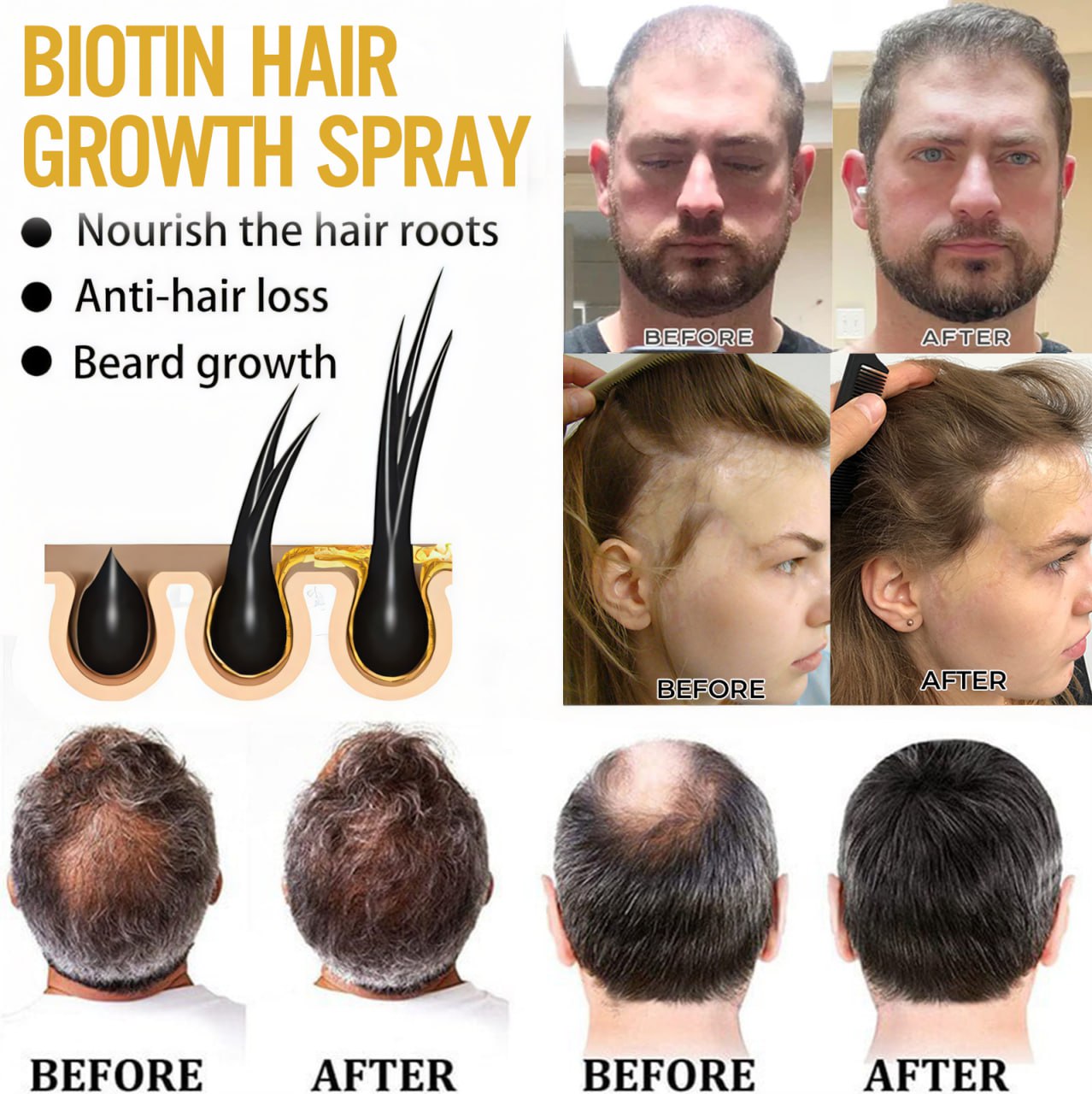 🔥 Grow Your Glow: 60% OFF 🔥 Cvreoz® Biotin Hair Essential Oil!